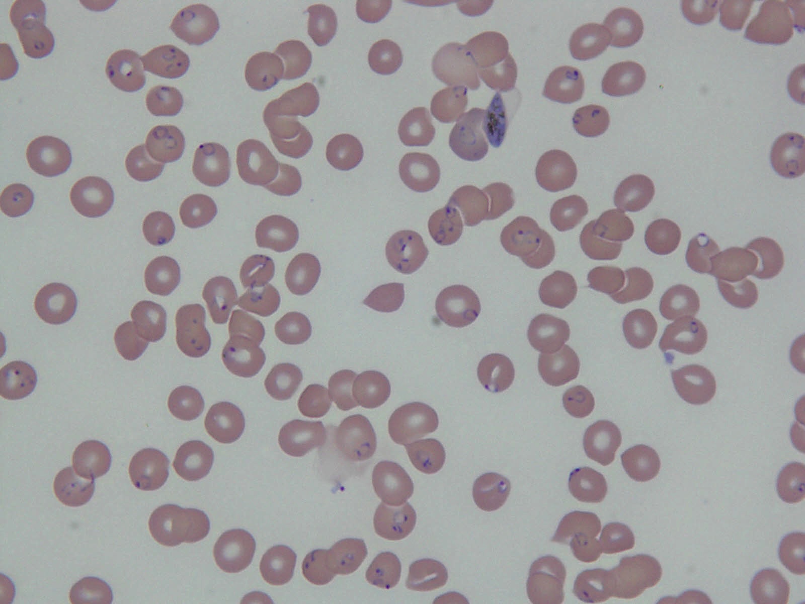 why is primaquine given in falciparum malaria