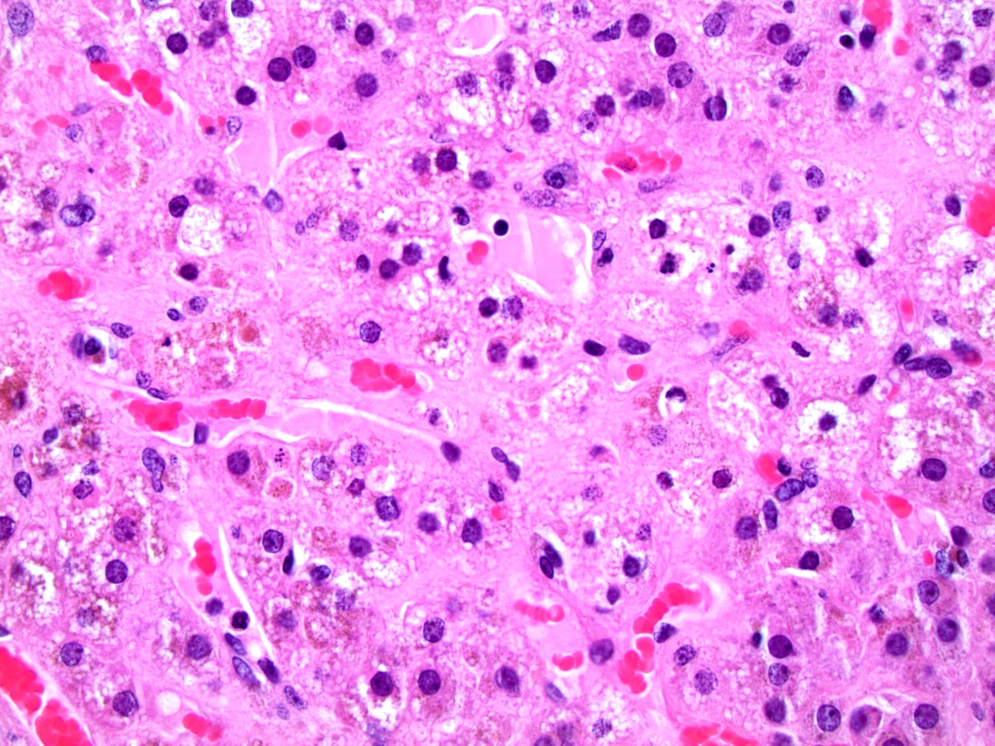 Pathology Outlines - Histology-adrenal cortex