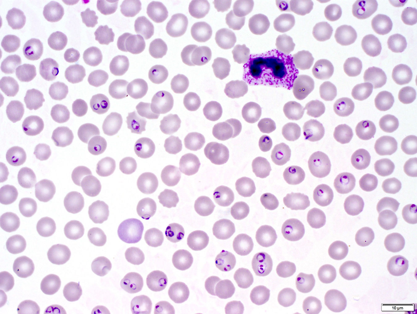 Malaria Identification Chart