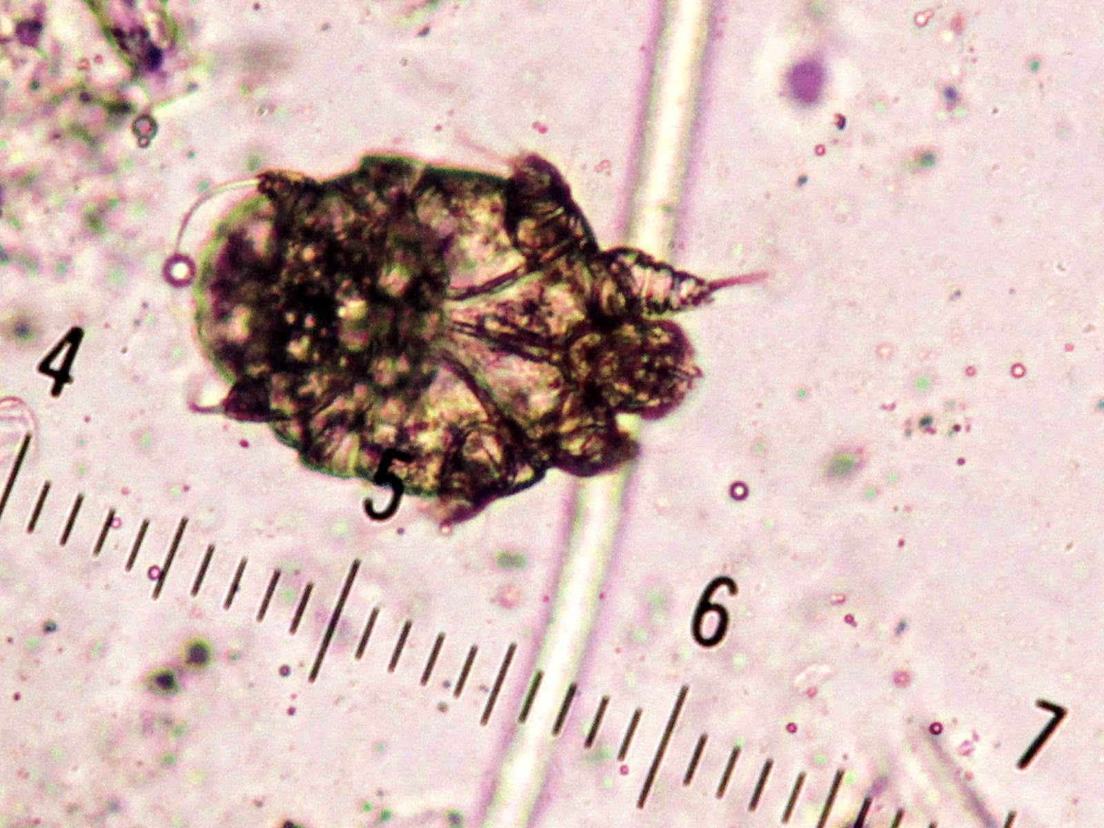 Pathology Outlines Scabies Mite