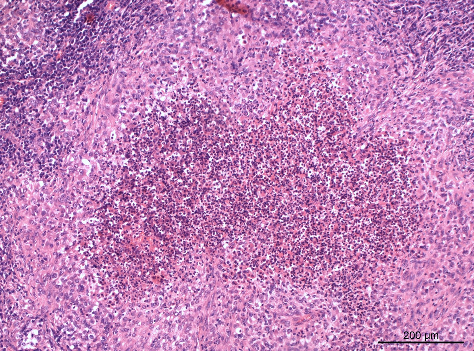 Pathology Outlines - Case of the Month #516
