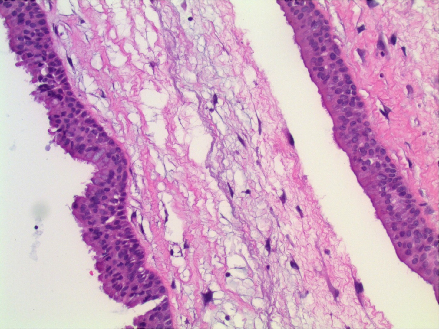 investing papilloma picture