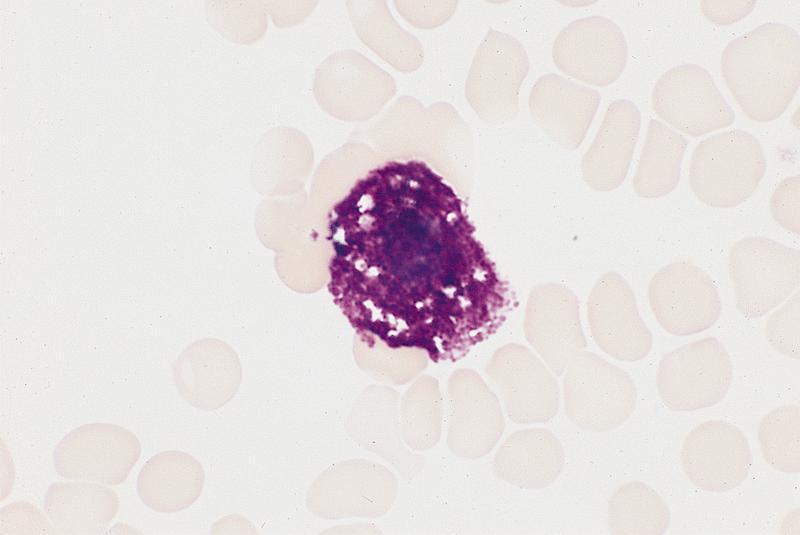 Scattered mast cells with basophilic granules