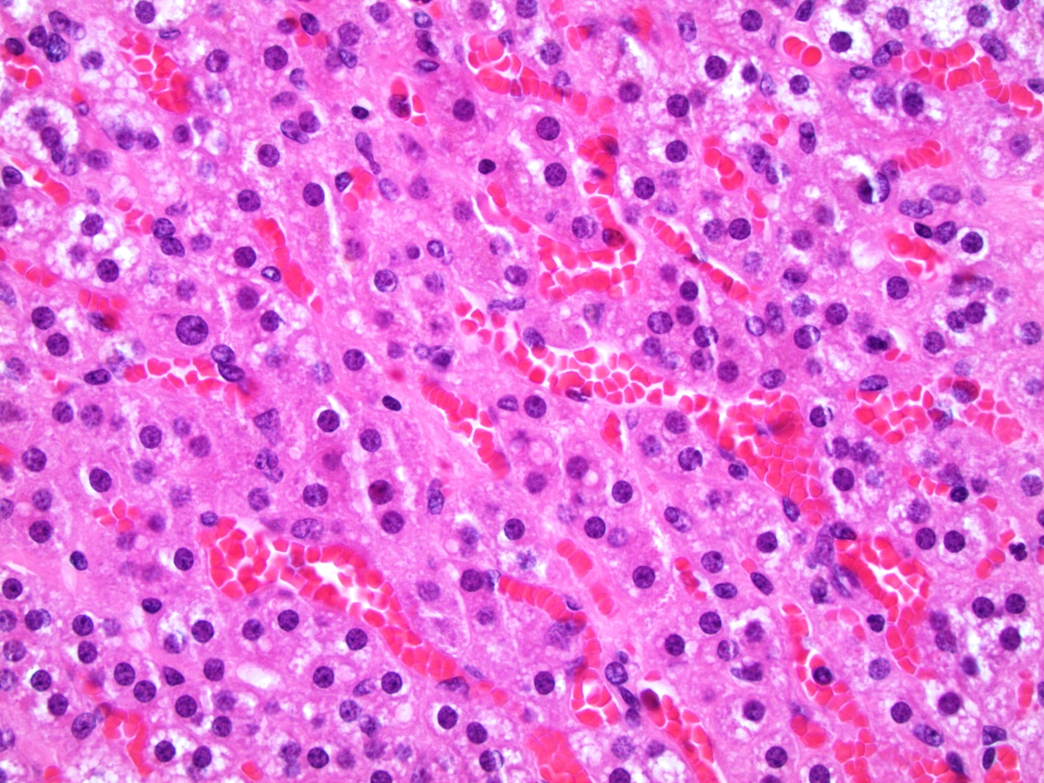 Adrenal Histology