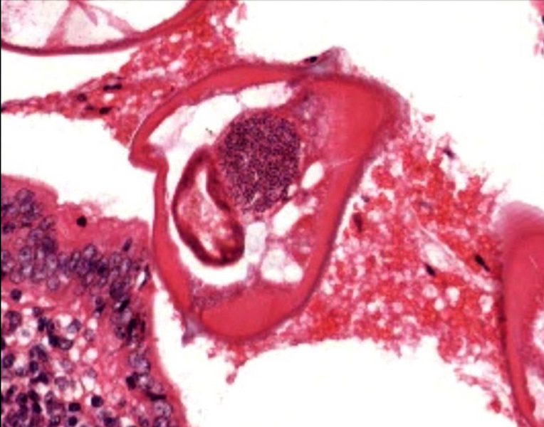 Male <i>Enterobius</i> adult worm