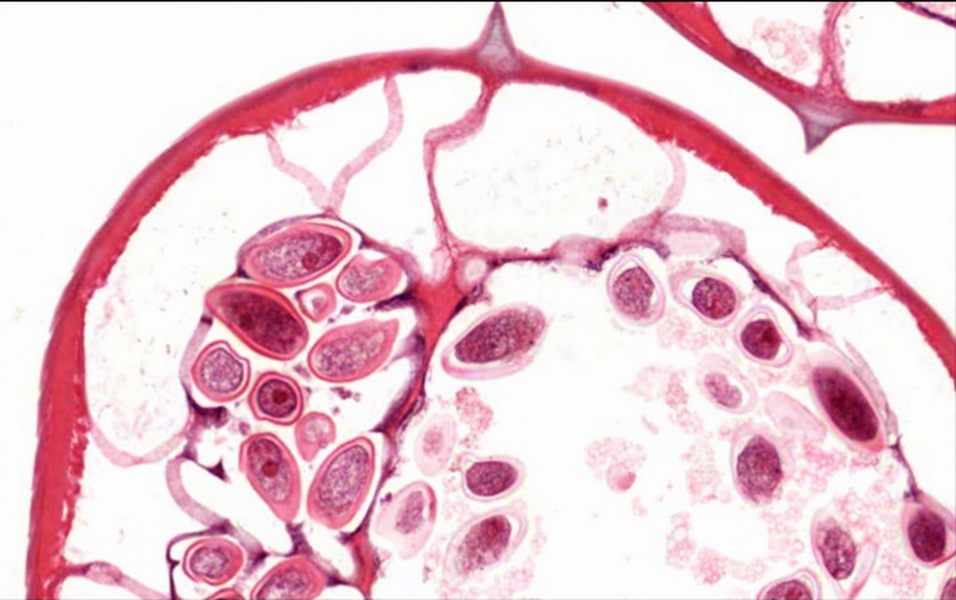 Enterobius vermicularis icd 10, Az enterobiasis kórokozója a pinworm