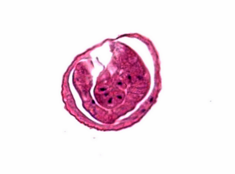 <i>Enterobius</i> egg with larva