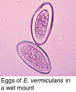 enterobius vermicularis mérete)