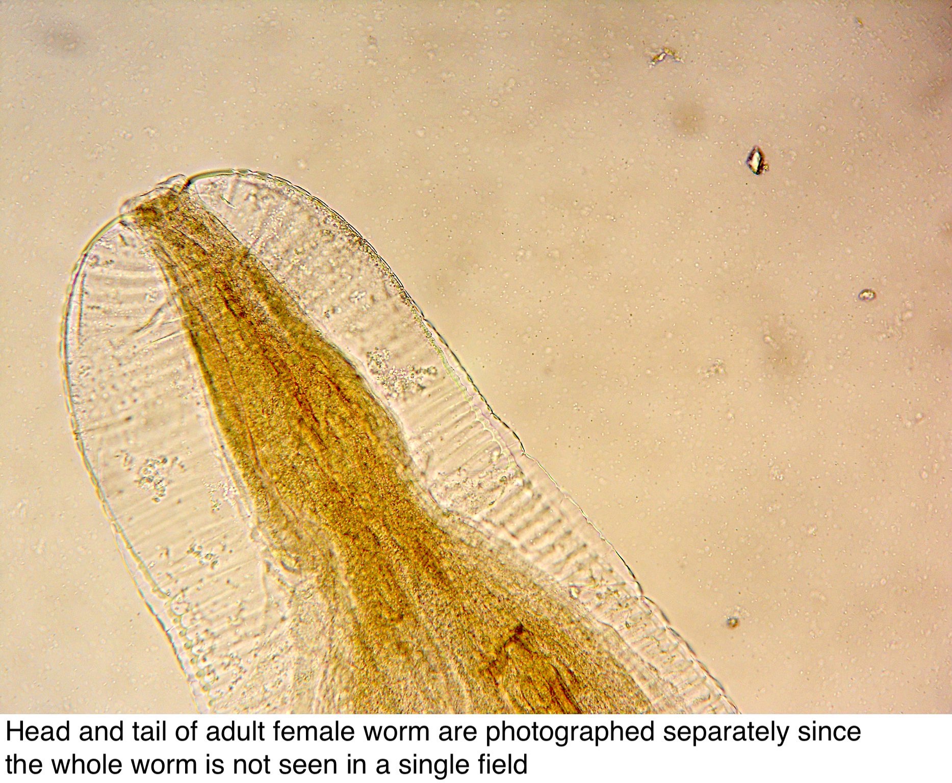 larvas de oxyuris vermicularis