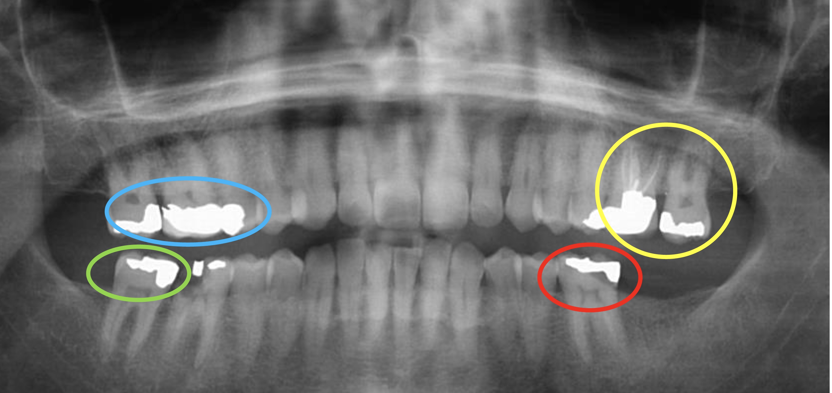 Antemortem dental radiography
