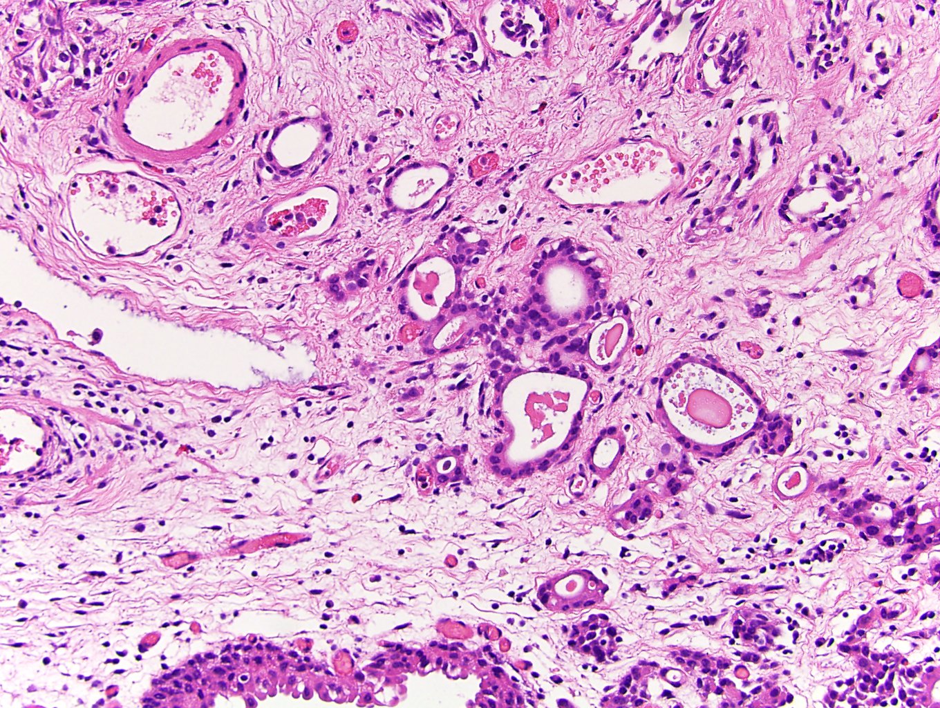 Microcysts, macrocysts and tubules