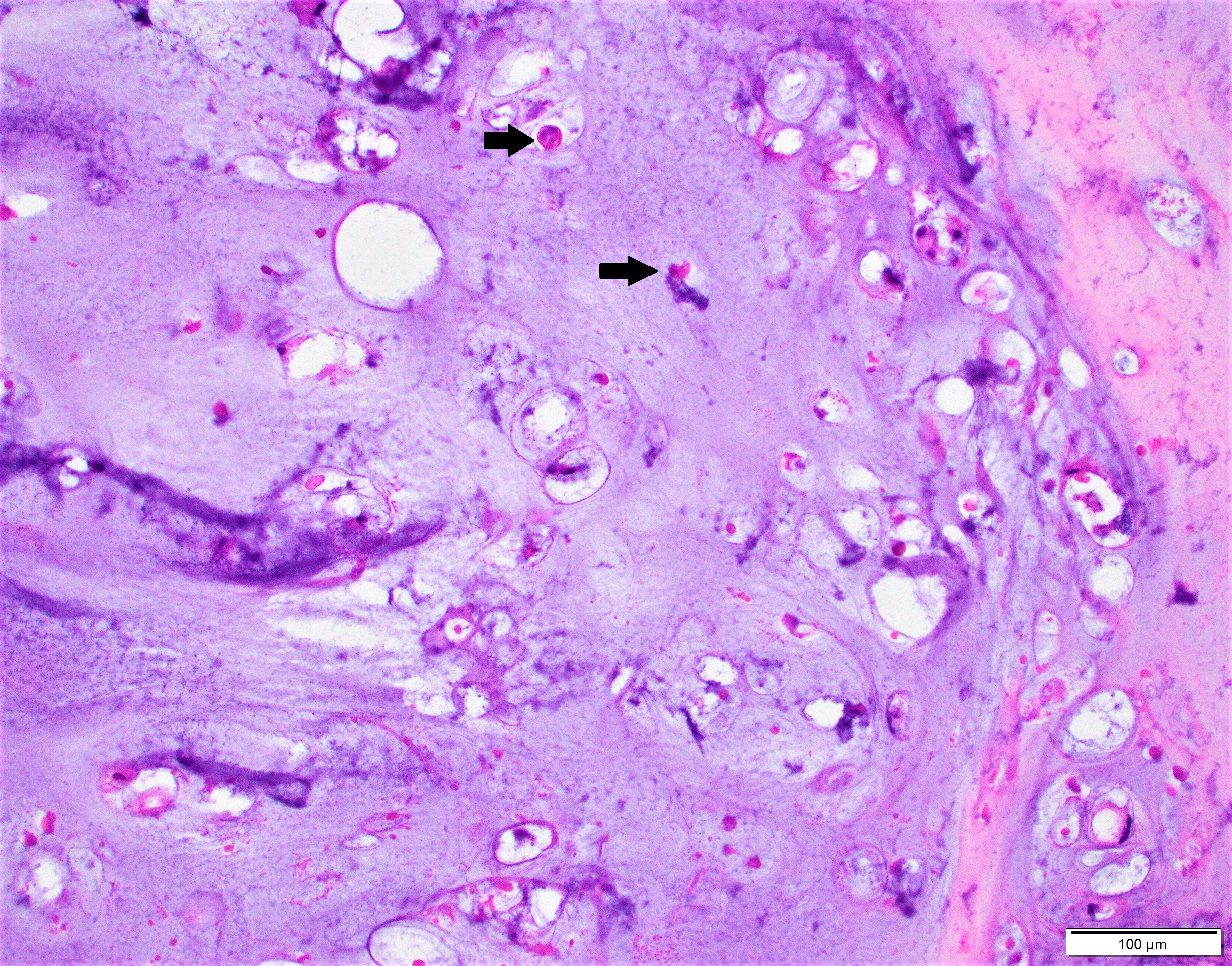 Gyerekkori tumorok. Dr. Hal{sz Judit PhD - PDF Free Download