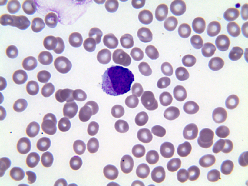 Peripheral blood mast cell