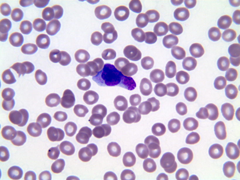 Peripheral blood mast cell