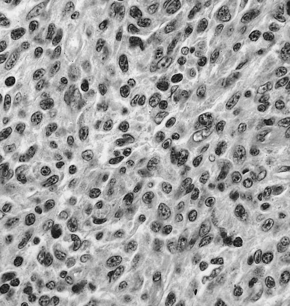 Ovoid nuclei with eosinophilic cytoplasm