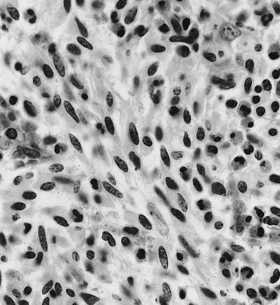 Spindle shaped mast cells