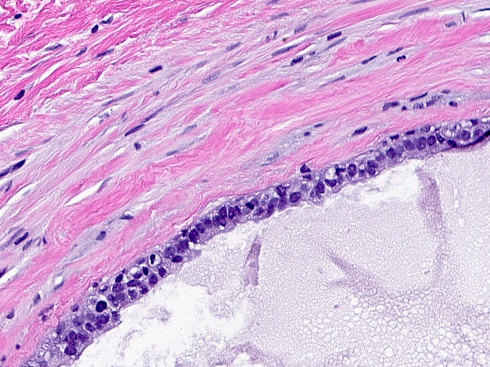 Simple epithelial lining