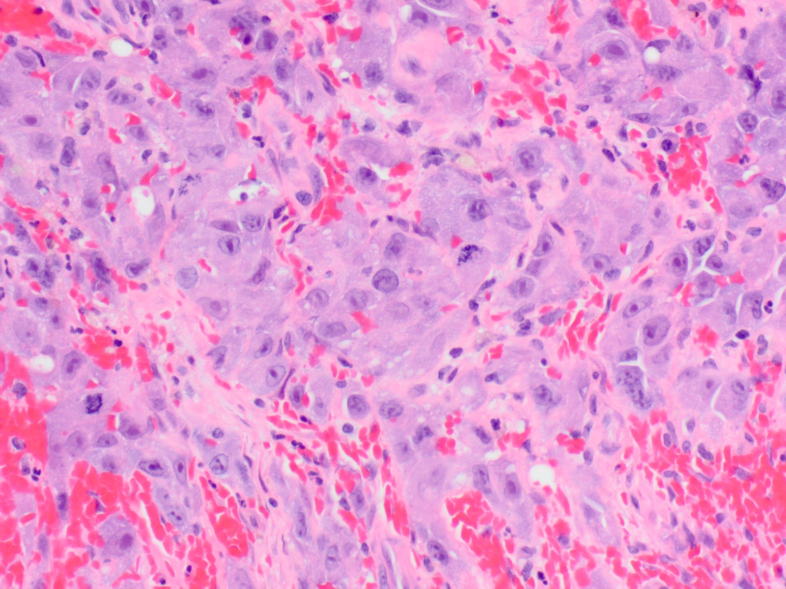 Epithelioid cells
