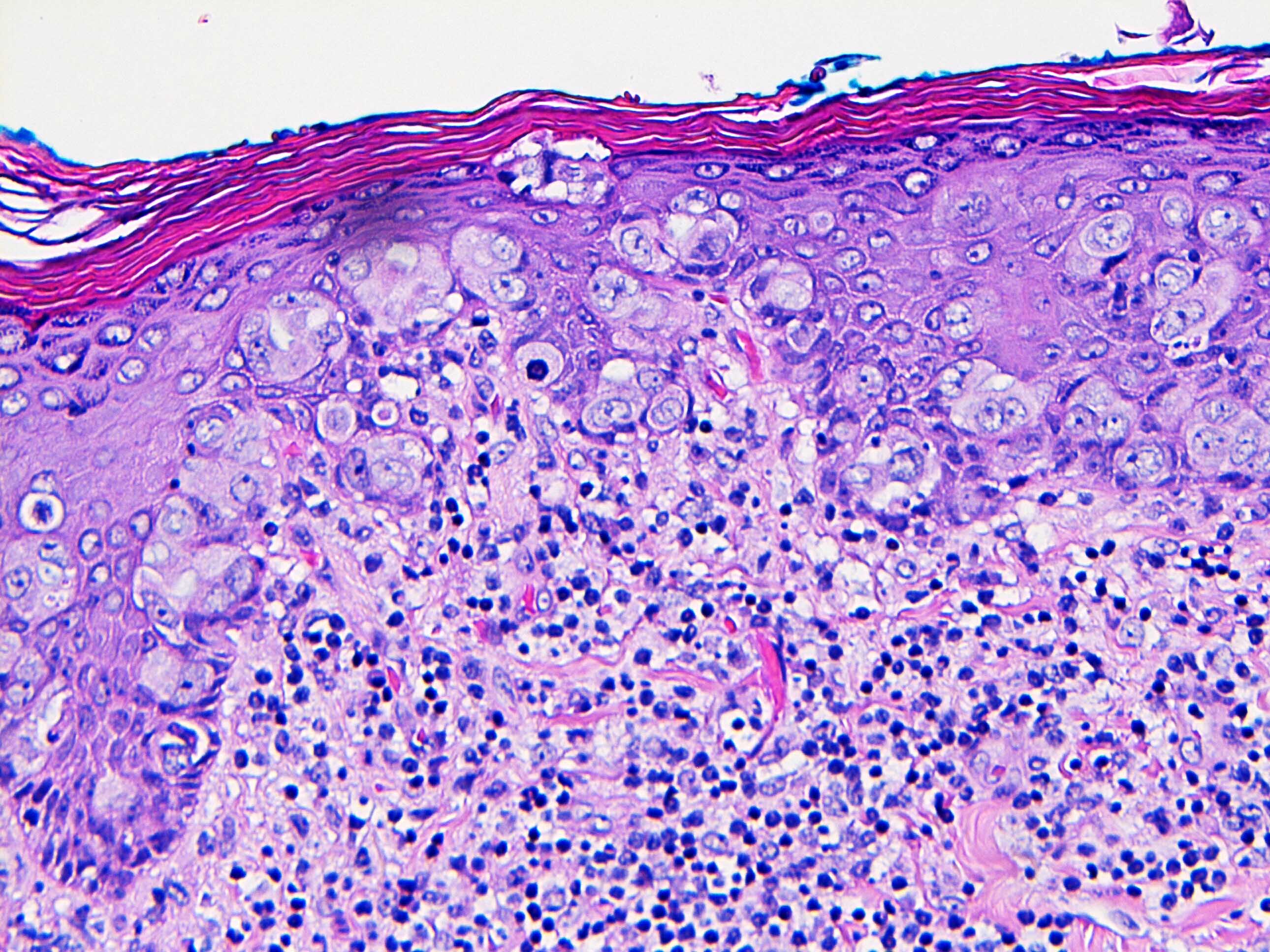 Cytologic features