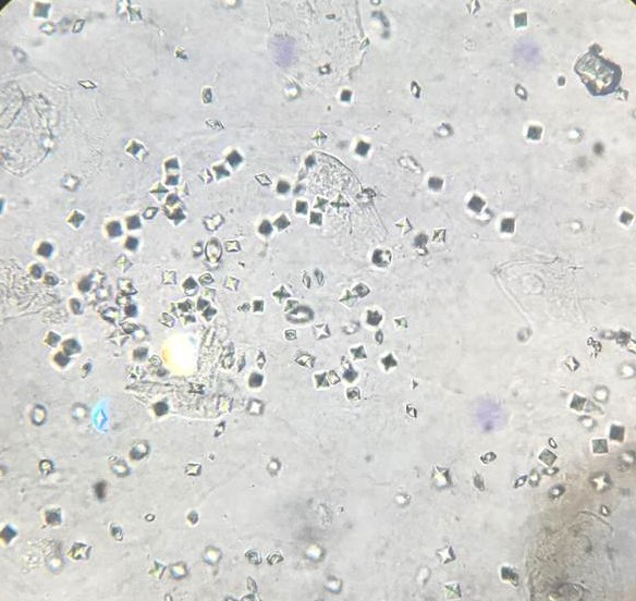 Calcium oxalate crystals