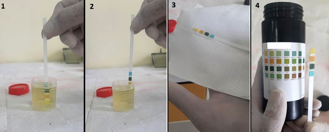 Steps in urine dipstick test