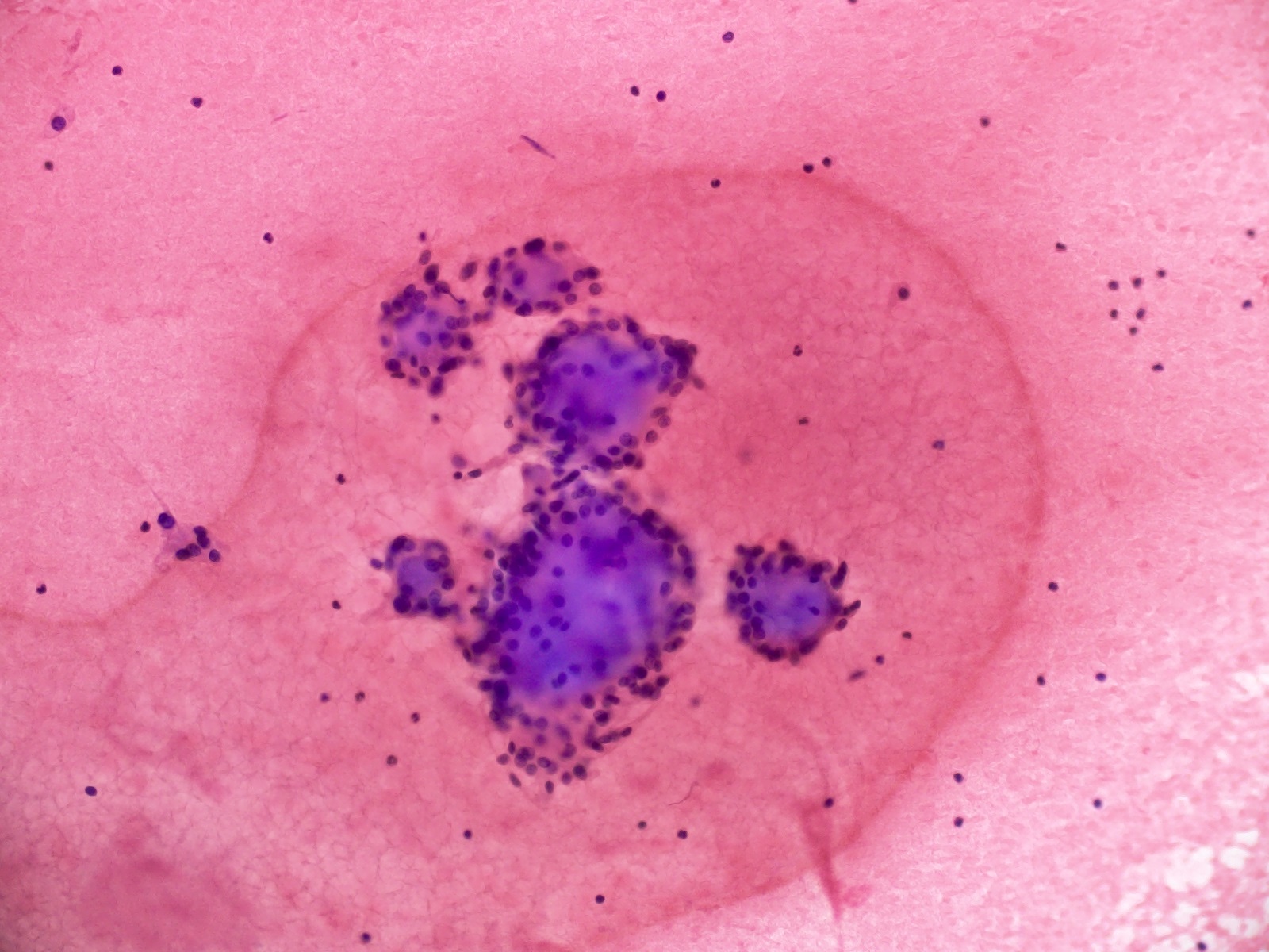 Stromal globules