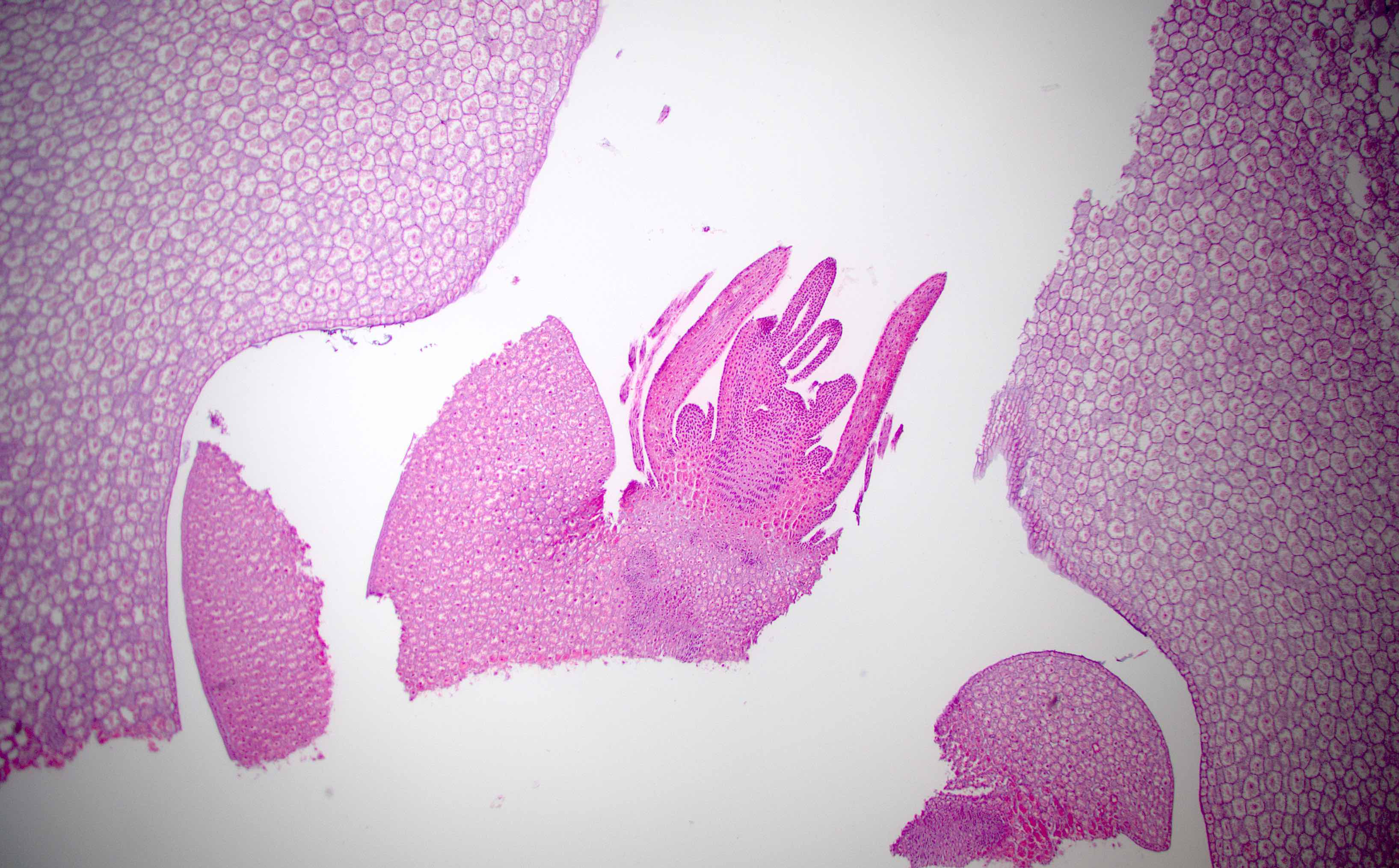 Pathology Outlines - Foreign materials / food