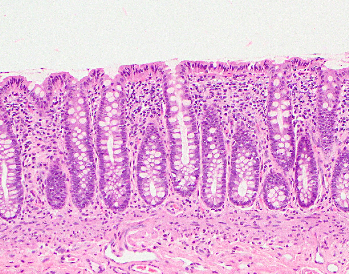 Colon Histology Slides Labeled