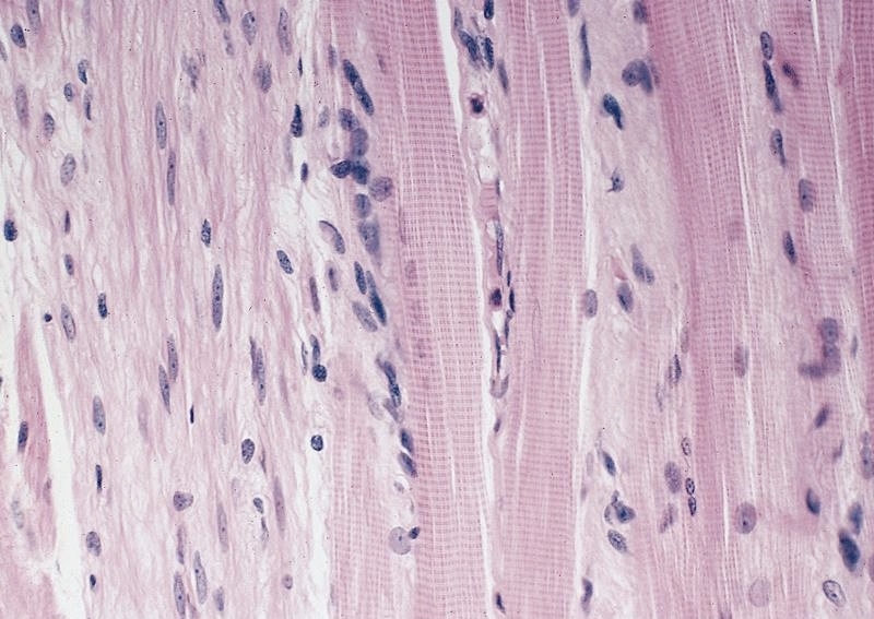 smooth and skeletal muscle