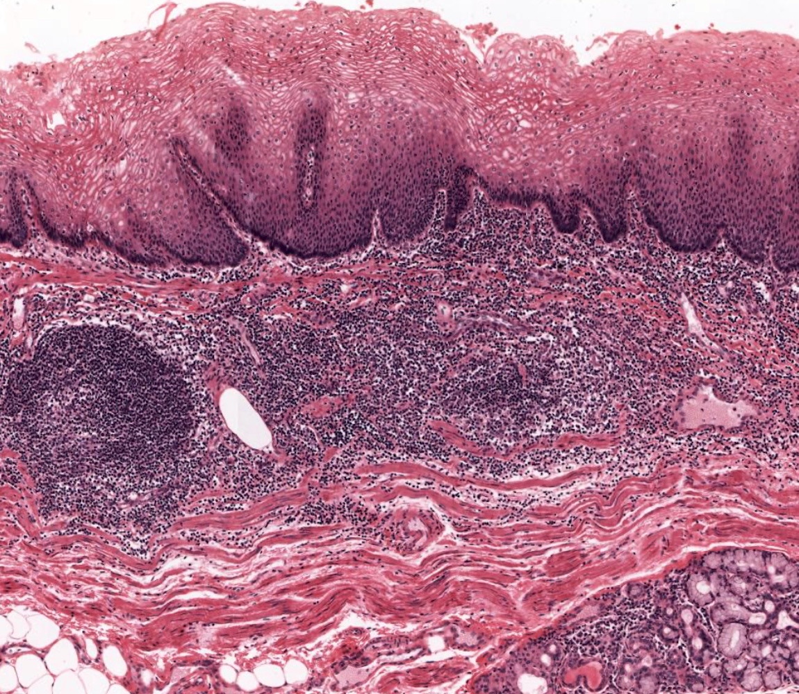 Mucosal lymph nodule, submucosal gland