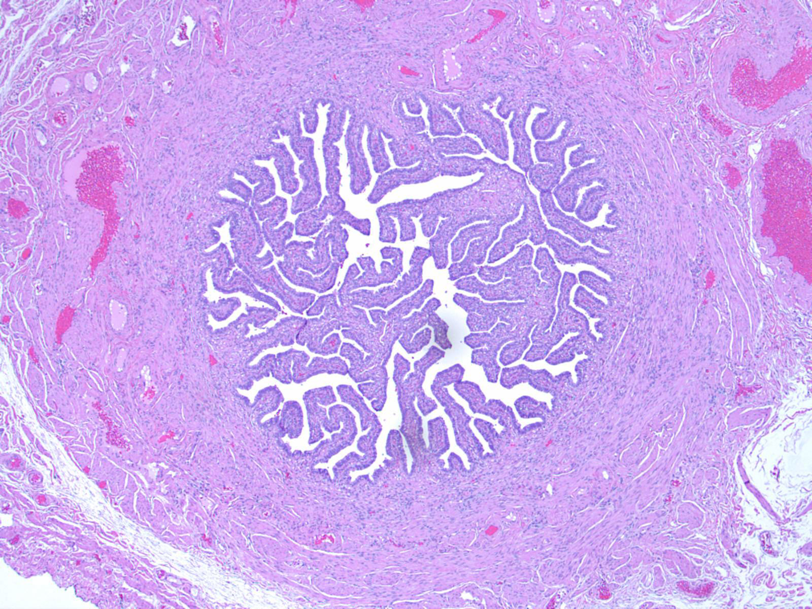 Histology - Uterine Tube - Histology Flashcards