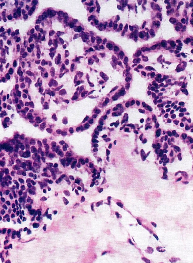 Bland, cuboidal epithelial cells