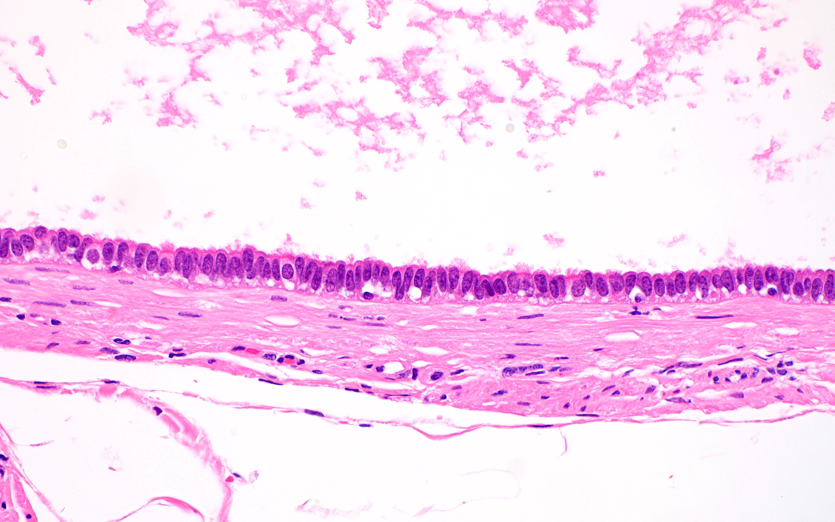 Bland, ciliated, tubal type epithelium