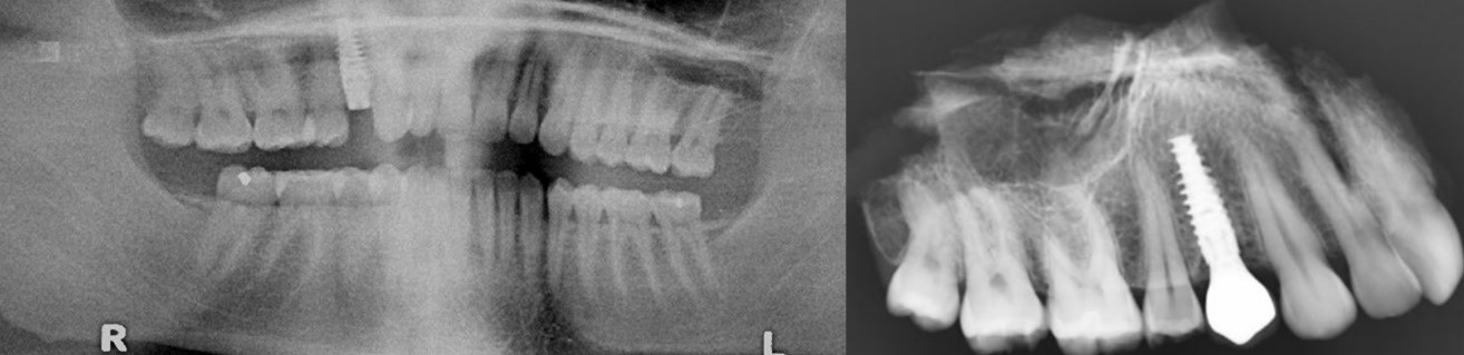 Comparative dental radiography