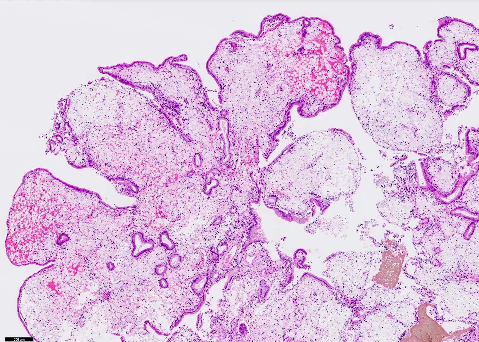 Stromal macrophages