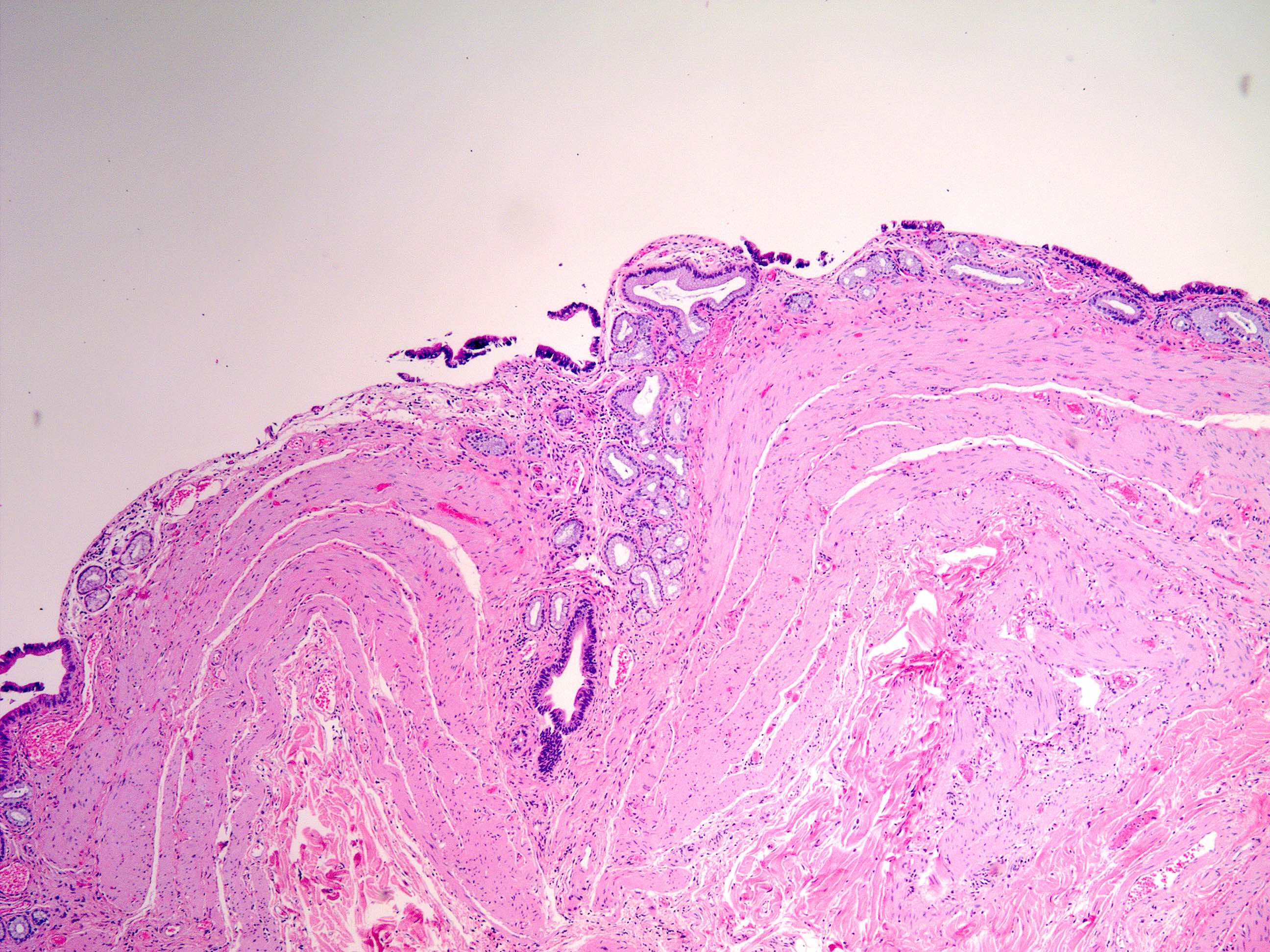 Histology Of Gallbladder