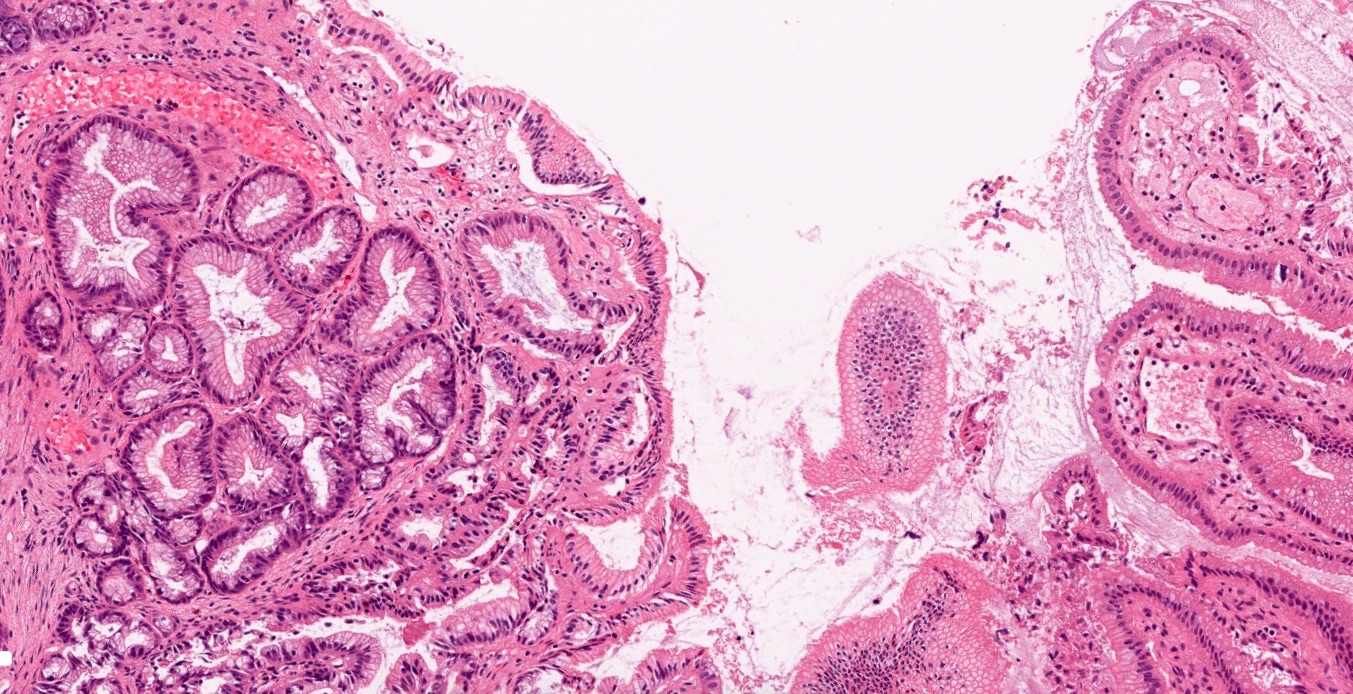 Gallbladder Histology Labeled