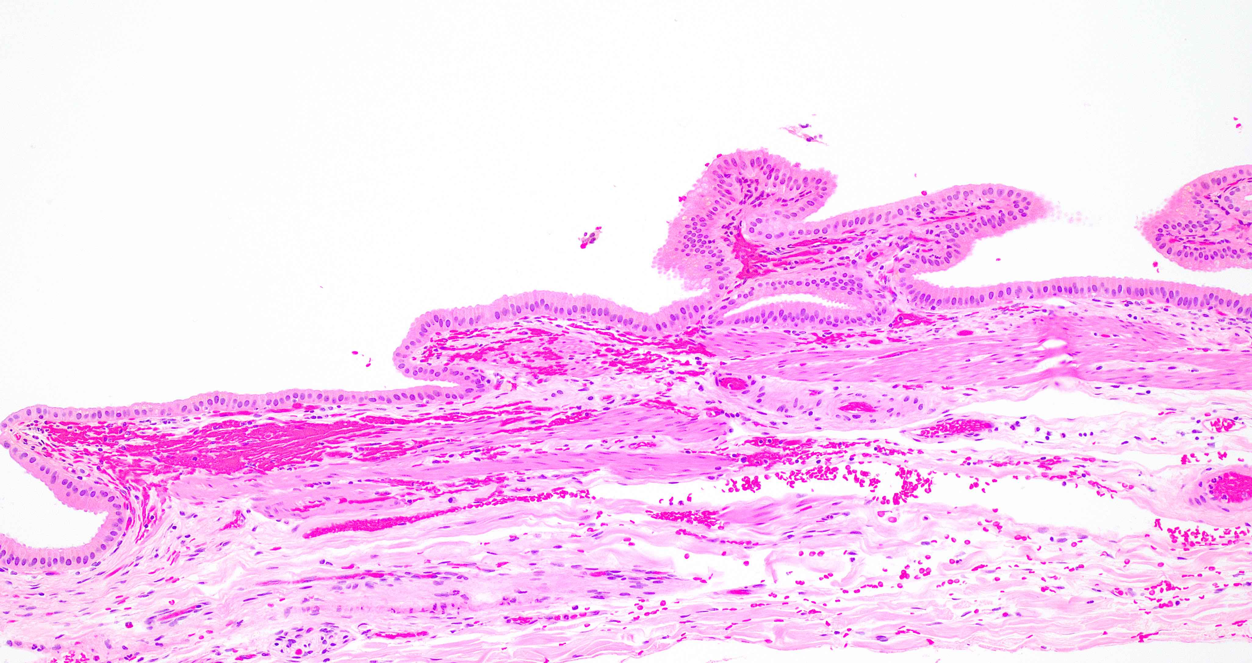Normal Gallbladder Histology