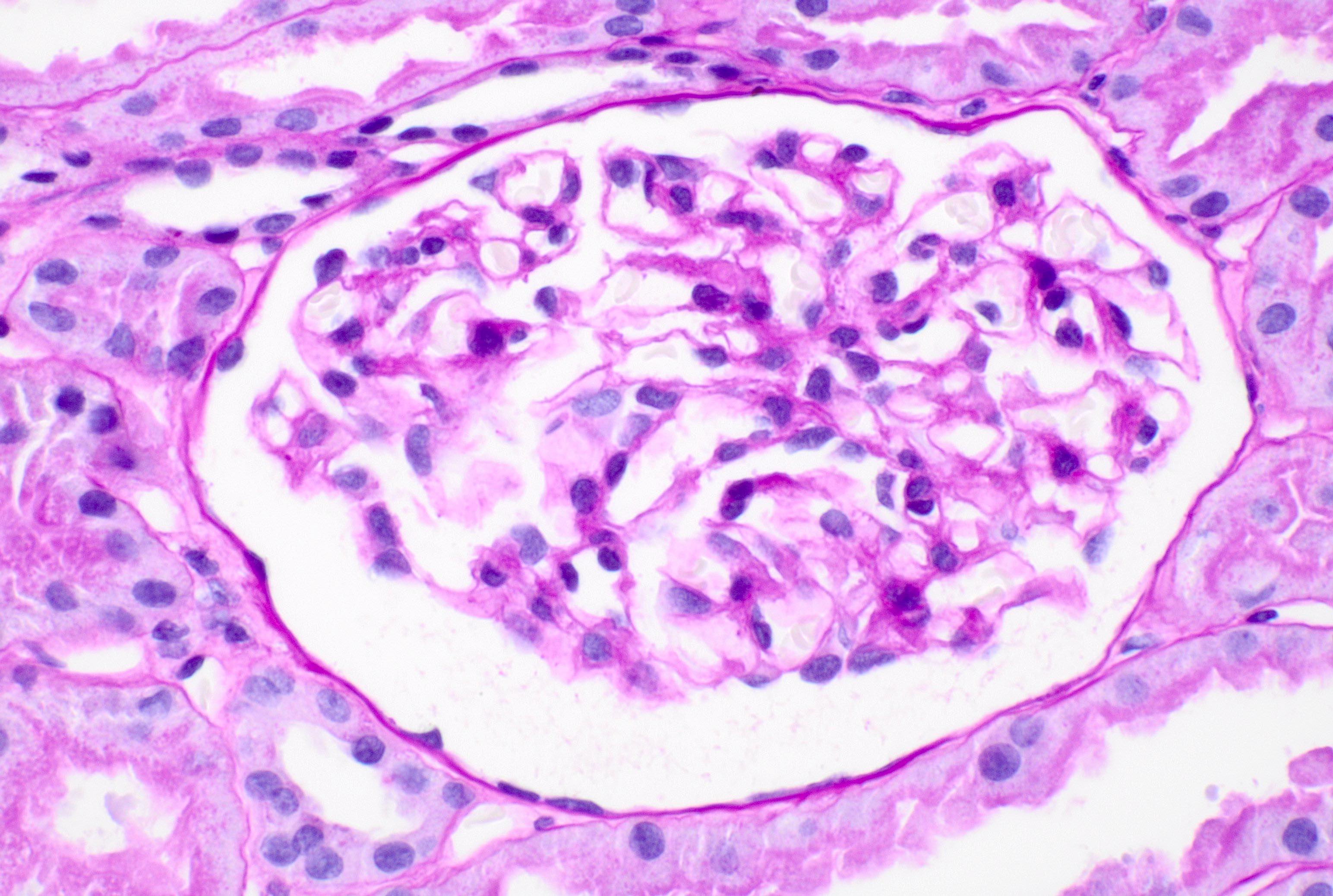 Normal glomerulus