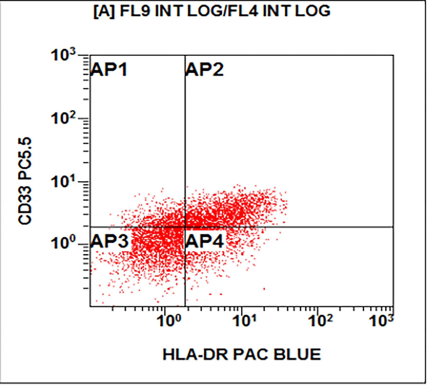 Increased blasts with HLA-DR, CD33