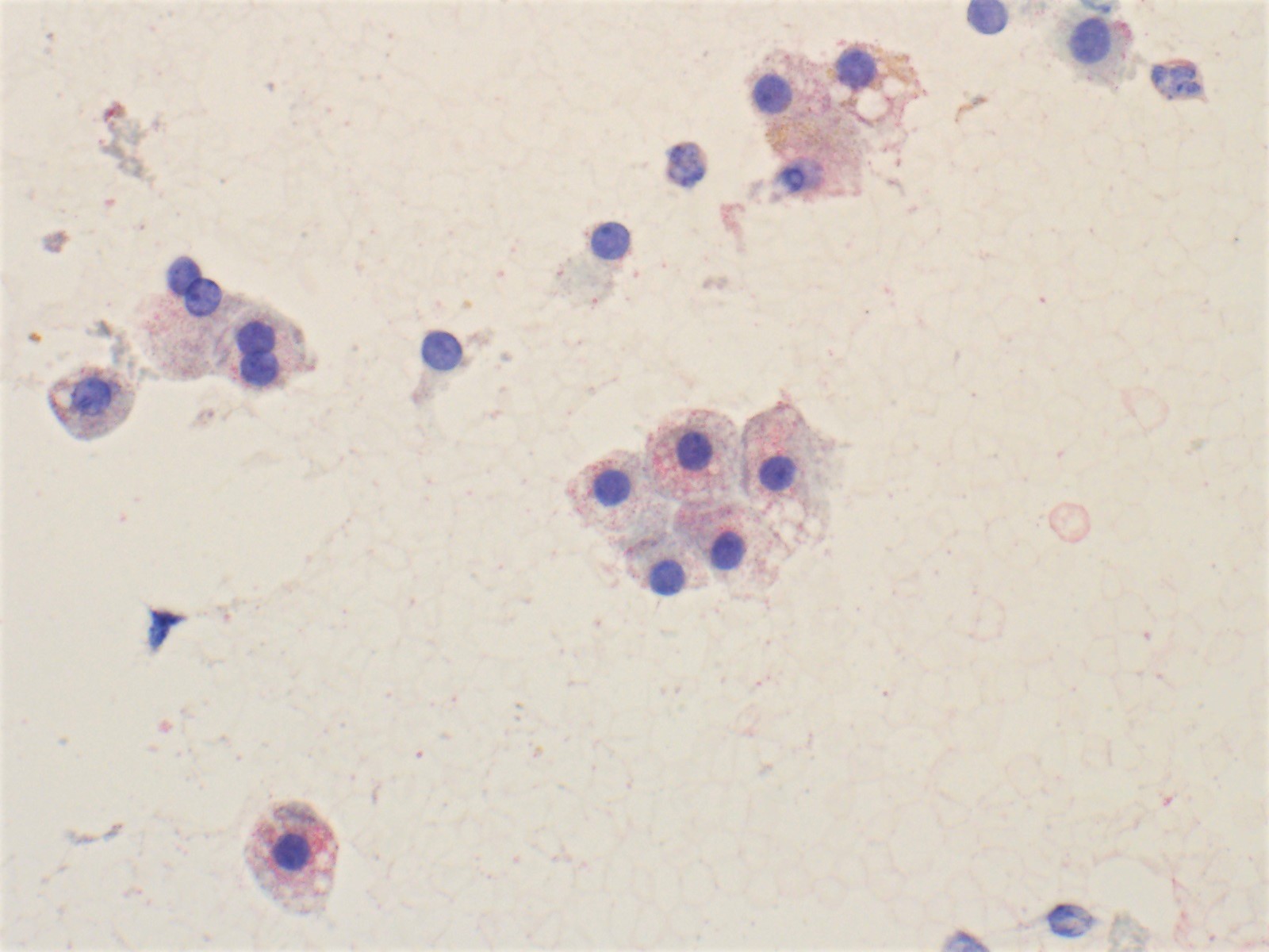 Benign hepatocytes, Pap