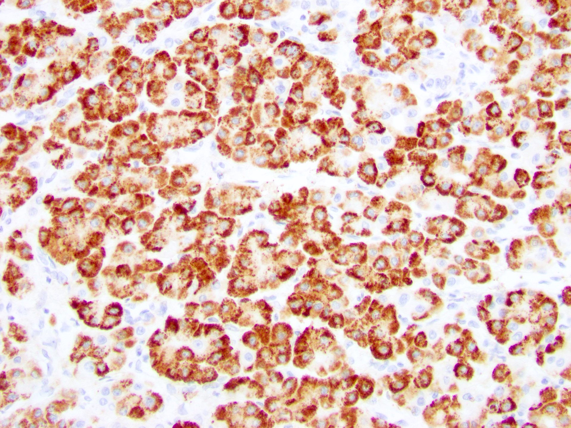 Hepatocyte Paraffin 1 (HepPar1)