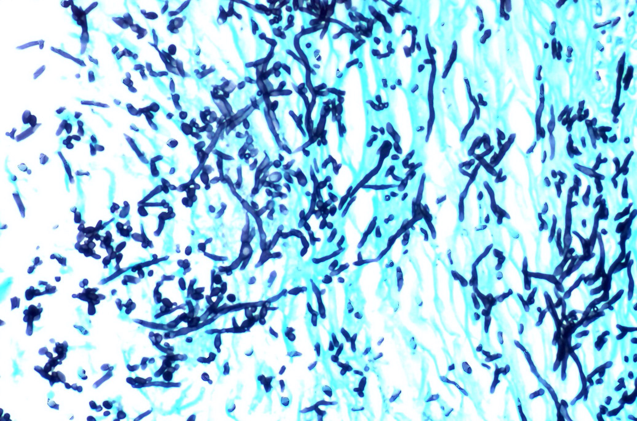 Lung: GMS staining