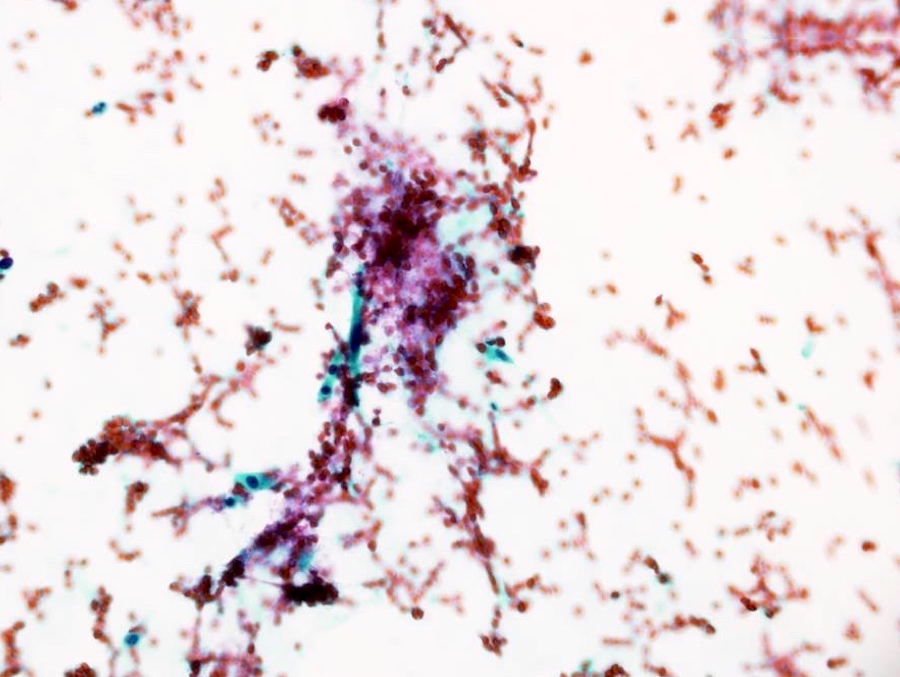 Papanicolaou (Pap) stain