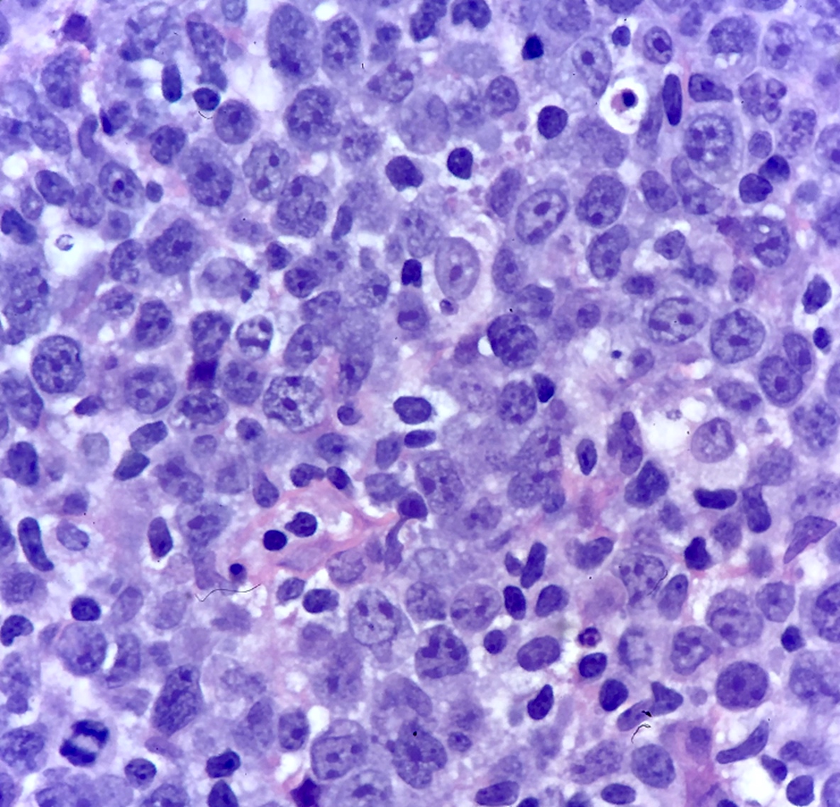 Cytologic features