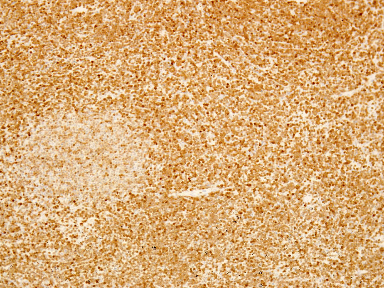 TCL1A staining in spleen