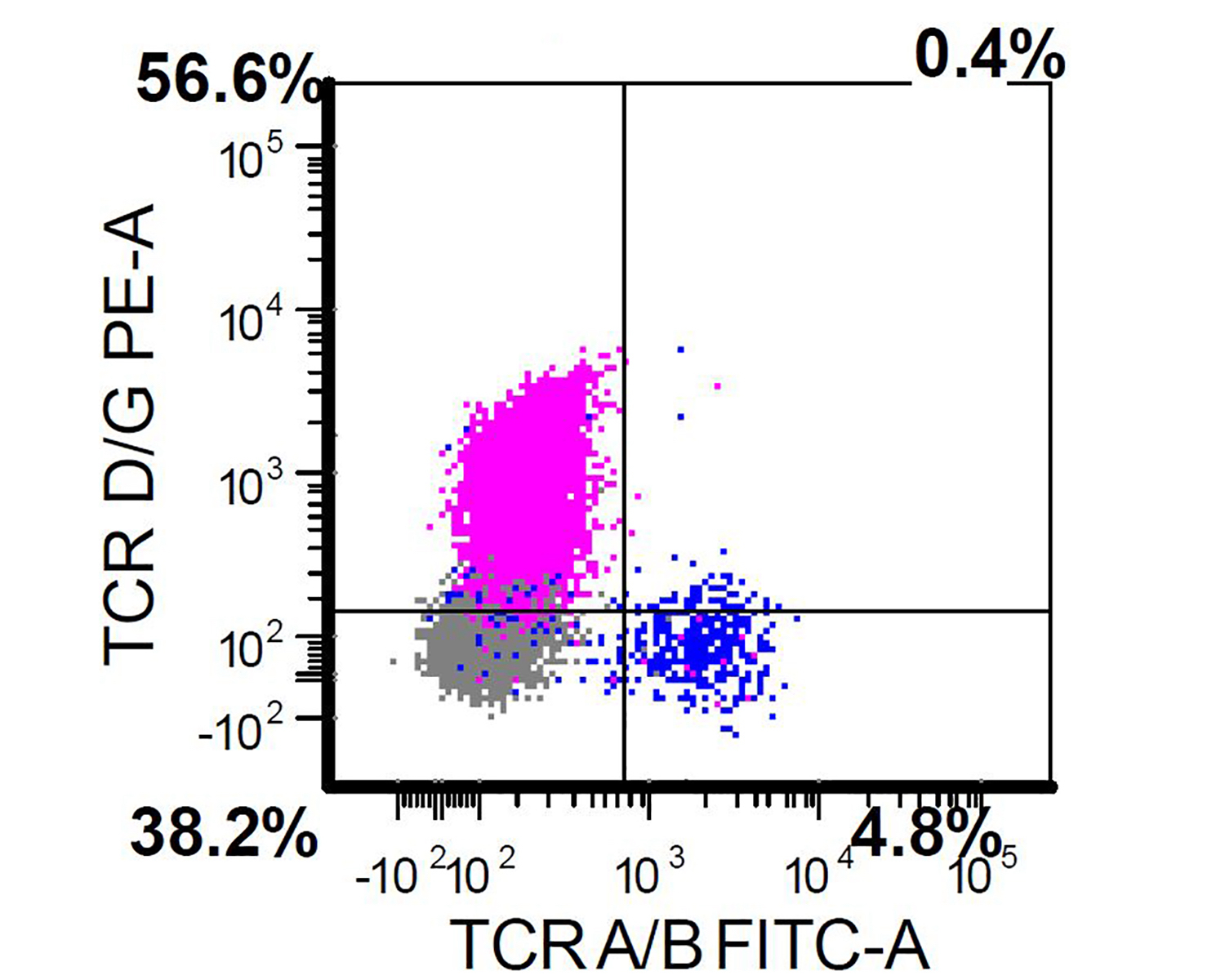 TCR gamma delta positivity and TCR alpha beta chain negativity