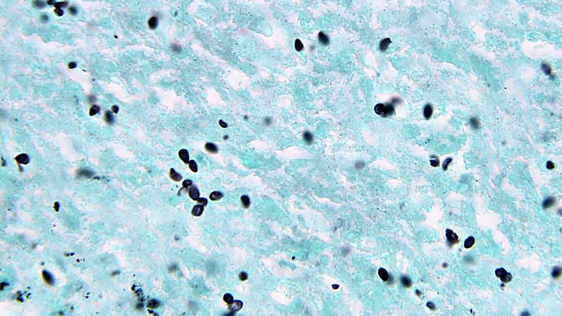 GMS small uniform single and clustered yeasts