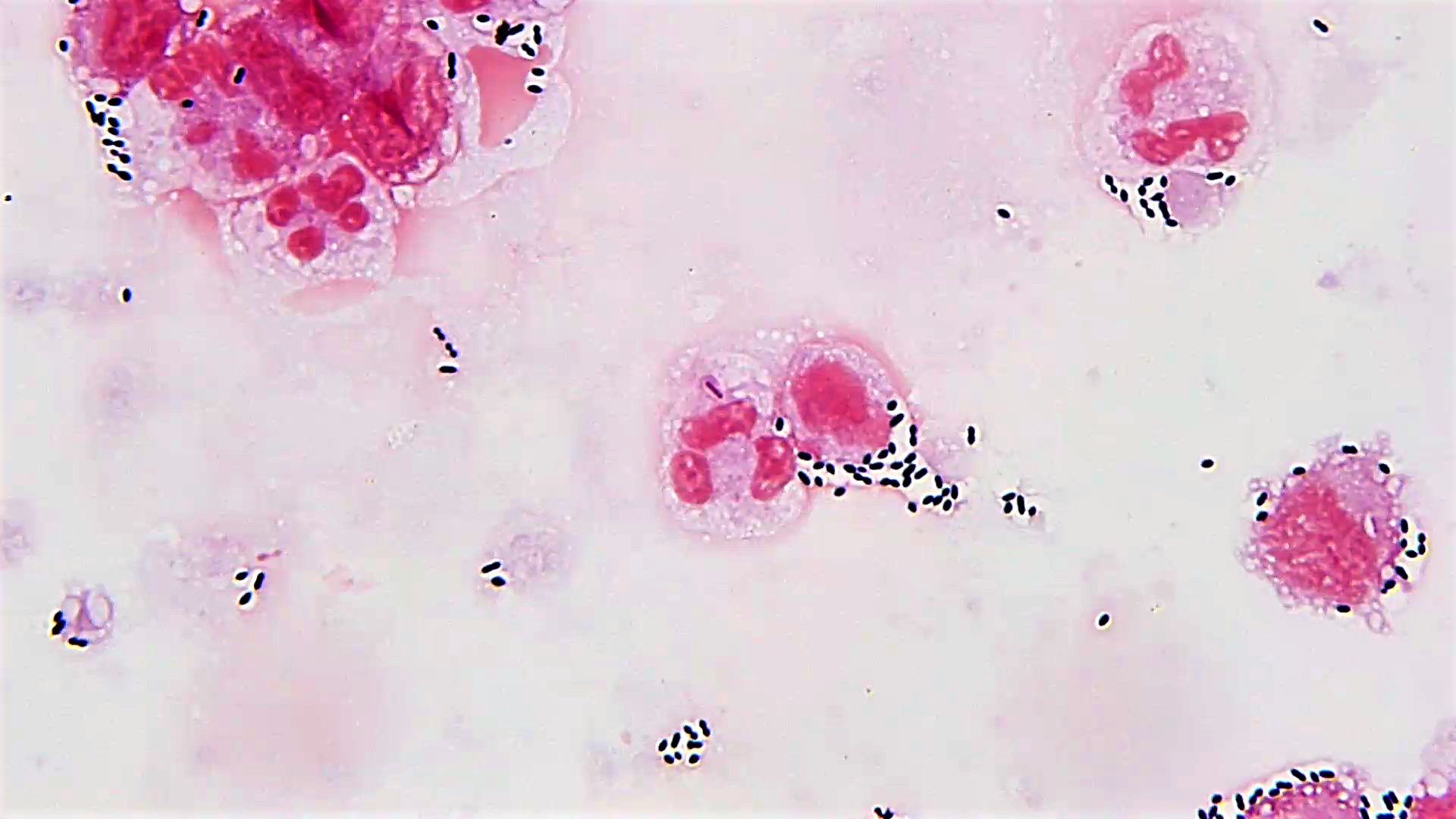 Streptococcus Ideas Microbiology Streptococcus Pneumoniae Hot Sex Picture