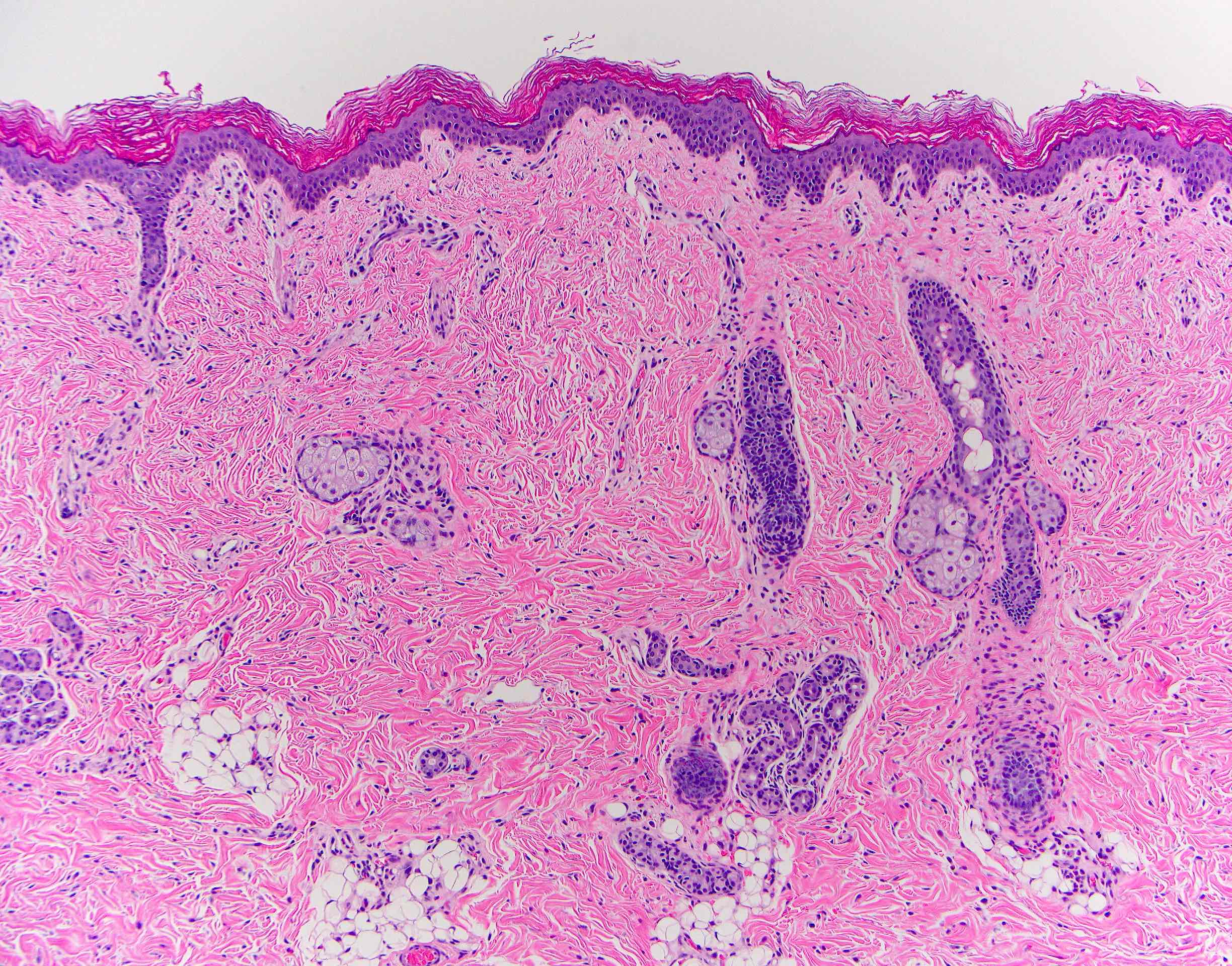 Stratified squamous epithelial lining